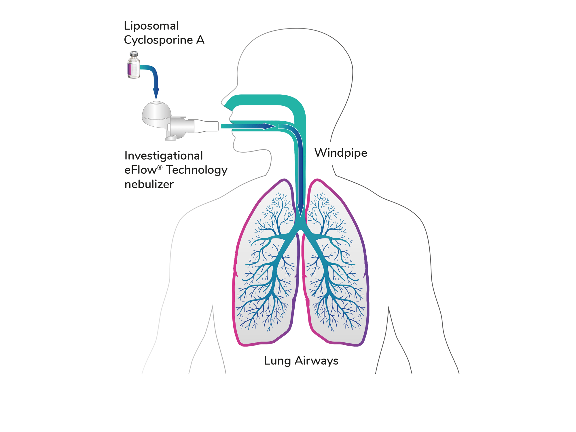 Inhaled Liposomal Cyclosporine A